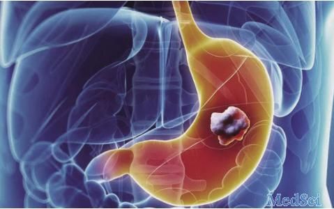 Gastric Cancer：长链非编码RNA CTD-2510F5.4在胃癌中的预后作用和临床病理意义
