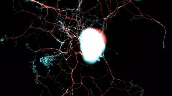 Neuron：修复神经纤维的<font color="red">关键</font><font color="red">蛋白</font>已被“捕获”