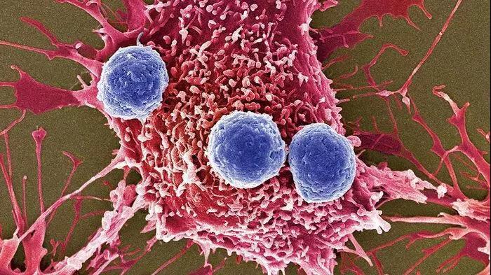 Nat Cell Biol：癌症免疫新机理：为何有时<font color="red">巨噬细胞</font>促进癌症