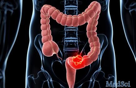 Clin Gastroenterology H：单用或联合氯吡格雷&低剂量阿司匹林可以降低结直肠癌的风险