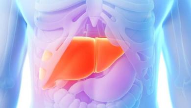 Clin Gastroenterology H：患有晚期肝病和门静脉高压症的患者不一定患有肝硬化