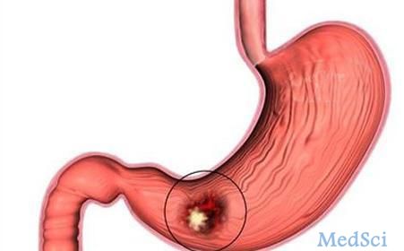 Gastric Cancer： 胃癌根治术术前C反应蛋白-白蛋白比值对早期复发和化疗的预测作用