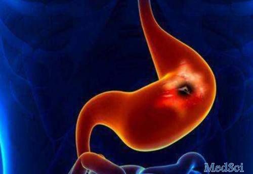 Gastric Cancer：腹腔灌洗液中SYT13和CEA mRNA水平可以预测胃癌腹膜复发风险