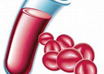 Blood：红系细胞分化过程中的黏连蛋白<font color="red">依赖</font>性的基因表达调控
