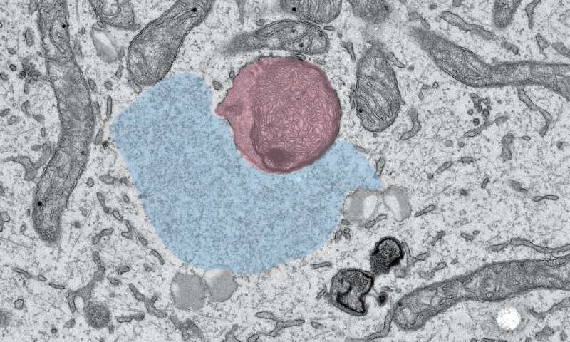 Cell：渐冻症新机制被揭示，致病基因阻碍了神经元中RNA“搭便车”