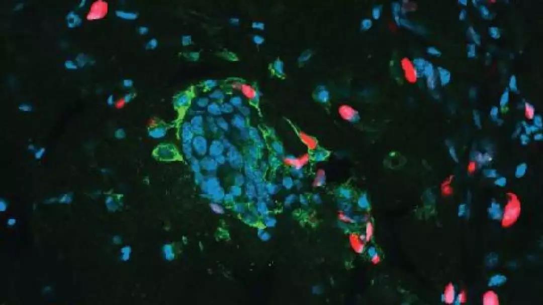 J Cell Biol：靠吃同类幸存！科学家揭示化疗后癌细胞“卷土重来”的秘密