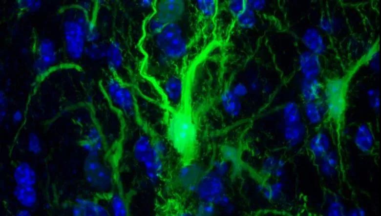 Brain：干细胞疗法新突破！植入大脑的干细胞长期存活，无需使用抗排斥药