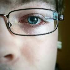 Eye：急性视网膜<font color="red">坏死</font>的超广角眼底成像的临床特征和视觉意义