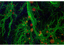 Nat Cell Biol：内质网-溶酶体接触是胆固醇依赖性mTORC1信号调控的枢纽