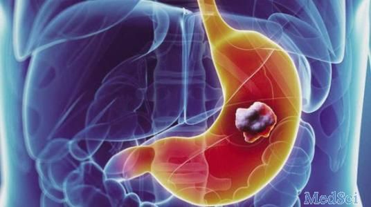 Gastric Cancer：血液和骨髓中角蛋白阳性CD44 +肿瘤细胞与胃癌患者预后不良相关
