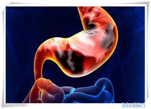 Gastric Cancer： 早期和晚期印戒细胞腺癌之间的临床病理差异
