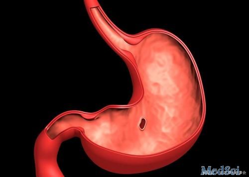 Gastric cancer：胃癌不同亚型的免疫状况的差异及其对预后的影响