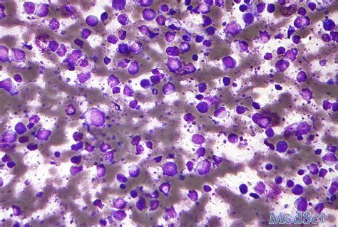 日本厚生劳动省：授予Polatuzumab vedotin治疗弥漫性大B细胞淋巴瘤的孤儿药认定