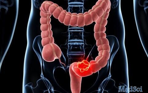 BMC Gastroenterology：不同阶段大肠癌不同病理亚型的预后分析