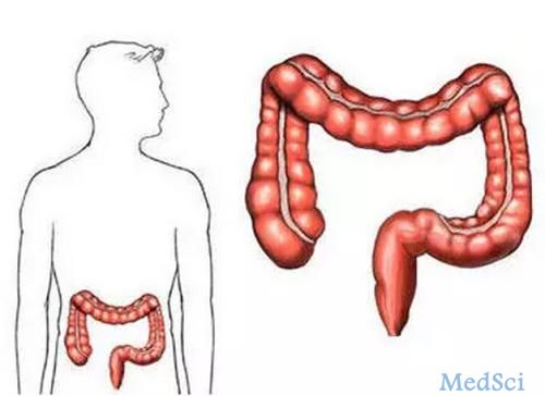 Clinical Gastroenterology H： 在小规模医院因小儿溃疡性结肠炎而接受结肠切除术的患者并发症更多