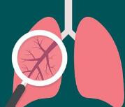 用于治疗慢阻肺的创新产品欧乐欣纳入国家医保目录