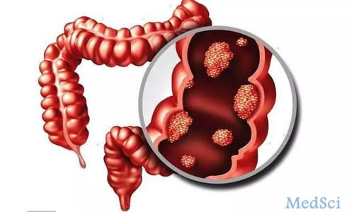 Clinical Translational Gastroenterology： 急性损伤期与愈合期溃疡性结肠炎中纤维化因子表达的差异