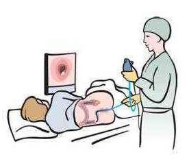 Clinical Translational Gastroenterology： 接受双重抗血小板药物治疗的患者行冷圈套息肉切除术后并发症风险