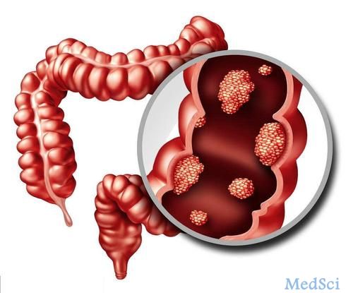Clinical Gastroenterology H： 慢性炎症性肠病活动的Nancy指数评分与大肠肿瘤发病相关