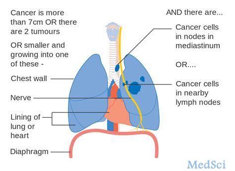 Spectrum的<font color="red">Poziotinib</font>未能达到II期肺癌研究的主要终点