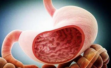 Clin Gastroenterology H：胃癌发病率不同的地区会影响移入人口的胃癌发病率