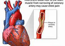 欧洲<font color="red">冠状动脉</font>腔<font color="red">内</font>成像专家共识解读