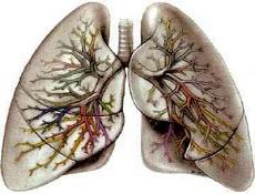Cell Death Dis：穿心莲内酯可有效缓解放射诱导性肺损伤