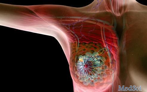 Lancet Oncol：Capivasertib联合氟维司群可显著延长晚期乳腺癌患者的无进展存活期