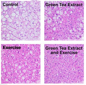J Nutr Biochem： 得了<font color="red">脂肪肝</font>怎么办？美动物研究称，绿茶+规律锻炼或有效