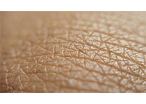 Lancet：润肤露不能降低新生儿湿疹风险