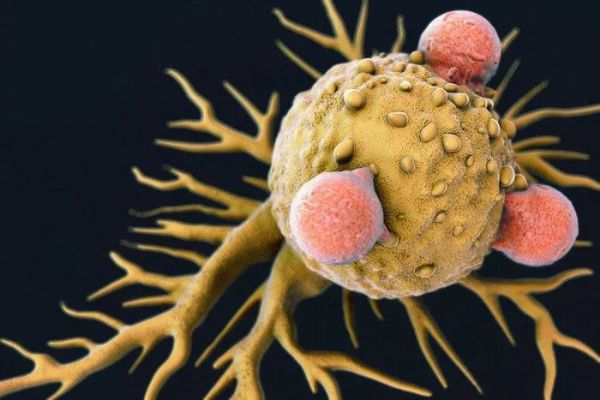 Nature：新型免疫细胞“动员”T细胞，更有效抗击“癌症之王”胰腺癌
