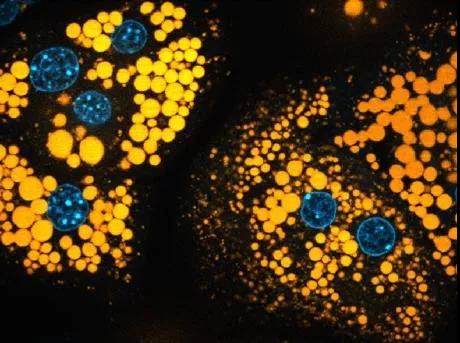 金黄色葡萄球菌疫苗为何不成功？激活T细胞可能是关键