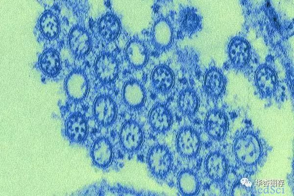 揭示真相：美国2009 H1N1流感疫情概况及抗疫事序
